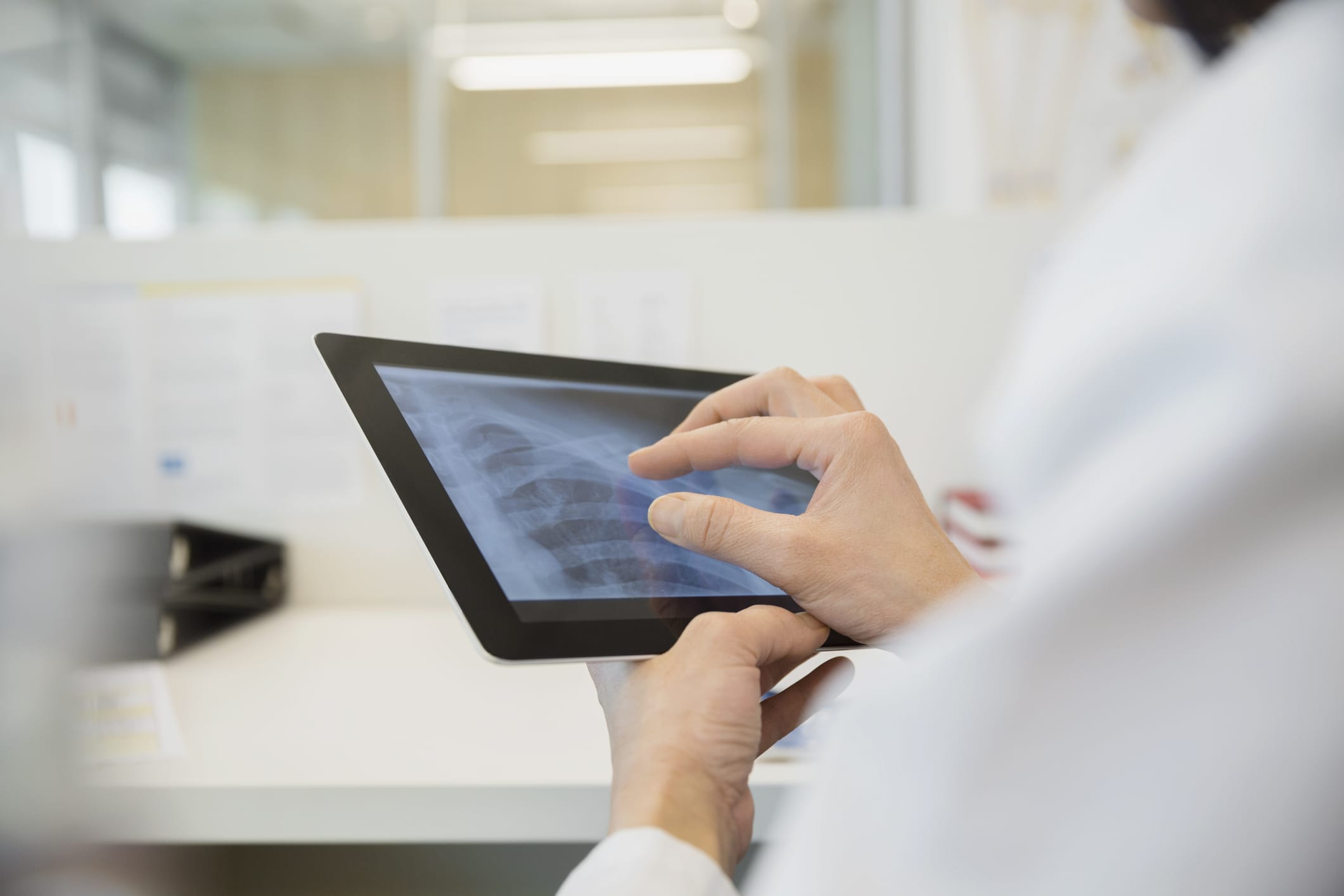 An immotherapist reviews a cancer patient's imaging scans on a tablet